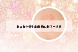 胸口有個像牛皮癬 胸口長了一塊癬