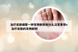 治療皮膚病第一種生物制劑有什么注意事項v 治療皮膚的生物制劑