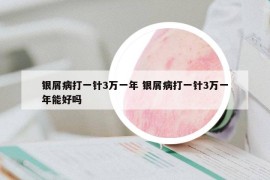 銀屑病打一針3萬(wàn)一年 銀屑病打一針3萬(wàn)一年能好嗎