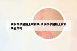 四歲孩子屁股上有白塊 四歲孩子屁股上有白塊正常嗎