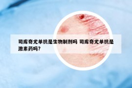 司庫奇尤單抗是生物制劑嗎 司庫奇尤單抗是激素藥嗎?
