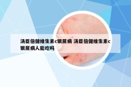 湯臣倍健維生素c銀屑病 湯臣倍健維生素c銀屑病人能吃嗎