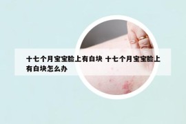 十七個月寶寶臉上有白塊 十七個月寶寶臉上有白塊怎么辦