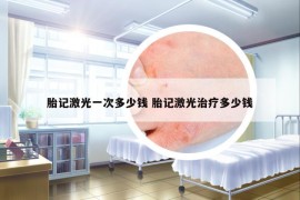 胎記激光一次多少錢 胎記激光治療多少錢