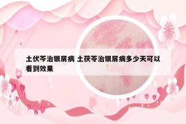 土伏芩治銀屑病 土茯苓治銀屑病多少天可以看到效果