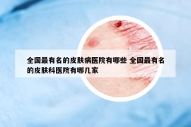 全國(guó)最有名的皮膚病醫(yī)院有哪些 全國(guó)最有名的皮膚科醫(yī)院有哪幾家