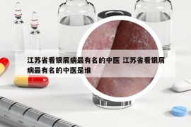 江蘇省看銀屑病最有名的中醫(yī) 江蘇省看銀屑病最有名的中醫(yī)是誰