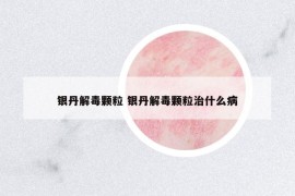 銀丹解毒顆粒 銀丹解毒顆粒治什么病