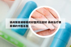 揚(yáng)州銀屑病哪看的好醫(yī)院比較好 揚(yáng)州治療銀屑病的中醫(yī)名醫(yī)