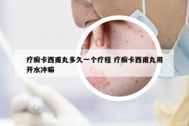 療癬卡西甫丸多久一個(gè)療程 療癬卡西甫丸用開水沖嘛