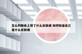 怎么判斷身上得了什么皮膚病 如何知道自己是什么皮膚病