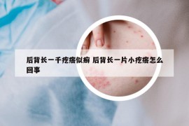 后背長一千疙瘩似癬 后背長一片小疙瘩怎么回事