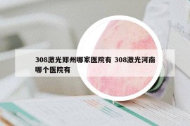 308激光鄭州哪家醫(yī)院有 308激光河南哪個(gè)醫(yī)院有