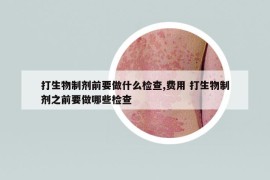 打生物制劑前要做什么檢查,費(fèi)用 打生物制劑之前要做哪些檢查