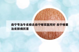 南寧專治牛皮癬去南寧哪家醫(yī)院好 南寧哪里治皮膚病厲害