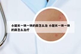 小腿長一塊一塊的蘚怎么治 小腿長一塊一塊的蘚怎么治療