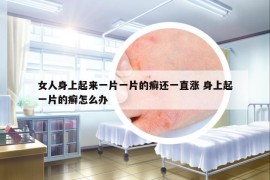 女人身上起來一片一片的癬還一直漲 身上起一片的癬怎么辦