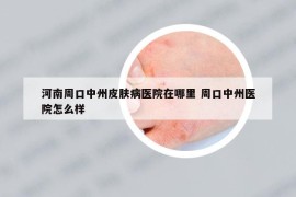 河南周口中州皮膚病醫(yī)院在哪里 周口中州醫(yī)院怎么樣