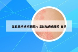 掌跎膿皰病初期圖片 掌跎膿皰病圖片 春季