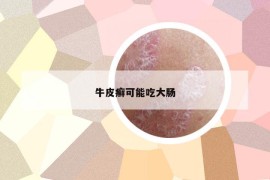 牛皮癬可能吃大腸
