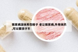 銀屑病涂抹男性精子 老公銀屑病,外用抹藥,可以要孩子不