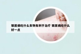 銀屑病吃什么食物有利于治療 銀屑病吃什么好一點
