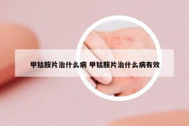 甲鈷胺片治什么病 甲鈷胺片治什么病有效
