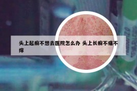 頭上起癬不想去醫(yī)院怎么辦 頭上長癬不痛不癢