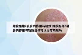 維胺酯維e乳膏的作用與功效 維胺酯維e乳膏的作用與功效請你可以治療雞眼嗎