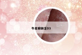 牛皮癬缺乏D3