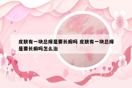 皮膚有一塊總癢是要長癬嗎 皮膚有一塊總癢是要長癬嗎怎么治