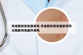 丹皮酚軟膏有激素嗎 丹皮酚軟膏有激素嗎可以擦臉嗎有副作用嗎