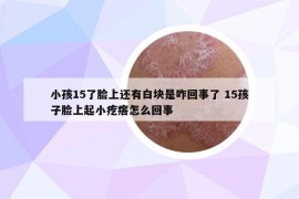 小孩15了臉上還有白塊是咋回事了 15孩子臉上起小疙瘩怎么回事