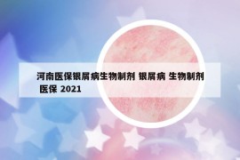 河南醫(yī)保銀屑病生物制劑 銀屑病 生物制劑 醫(yī)保 2021