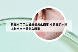 男孩小丁丁上長(zhǎng)癬是怎么回事 小男孩的小雞上長(zhǎng)小水泡是怎么回事