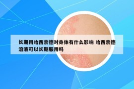 長期用哈西奈德對身體有什么影響 哈西奈德溶液可以長期服用嗎