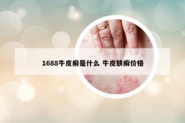 1688牛皮癬是什么 牛皮膚癬價格