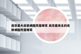 南京最大皮膚病醫(yī)院是哪家 南京最有名的皮膚病醫(yī)院是哪家