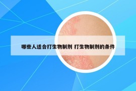 哪些人適合打生物制劑 打生物制劑的條件
