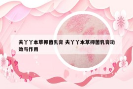 夫丫丫本草抑菌乳膏 夫丫丫本草抑菌乳膏功效與作用
