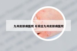 九州皮膚病醫(yī)院 石家莊九州皮膚病醫(yī)院