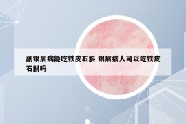 副銀屑病能吃鐵皮石斛 銀屑病人可以吃鐵皮石斛嗎