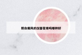 照白癜風的儀器管用嗎哪種好
