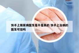 快手上銀屑病醫(yī)生是不是真的 快手上治病的醫(yī)生可信嗎