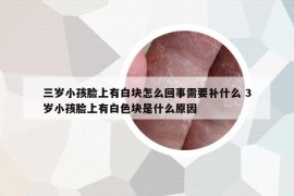 三歲小孩臉上有白塊怎么回事需要補(bǔ)什么 3歲小孩臉上有白色塊是什么原因