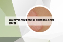 青島哪個醫(yī)院有生物制劑 青島哪里可以打生物制劑