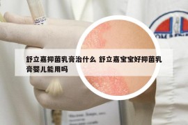 舒立嘉抑菌乳膏治什么 舒立嘉寶寶好抑菌乳膏嬰兒能用嗎