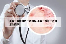 手背一大塊白色一曬很癢 手背一片白一片白怎么回事