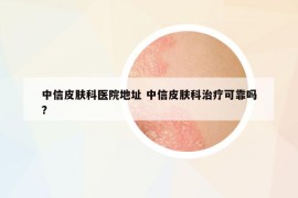 中信皮膚科醫(yī)院地址 中信皮膚科治療可靠嗎?