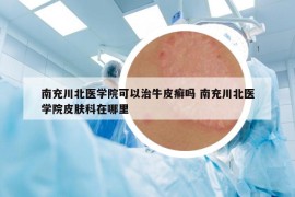 南充川北醫(yī)學(xué)院可以治牛皮癬嗎 南充川北醫(yī)學(xué)院皮膚科在哪里
